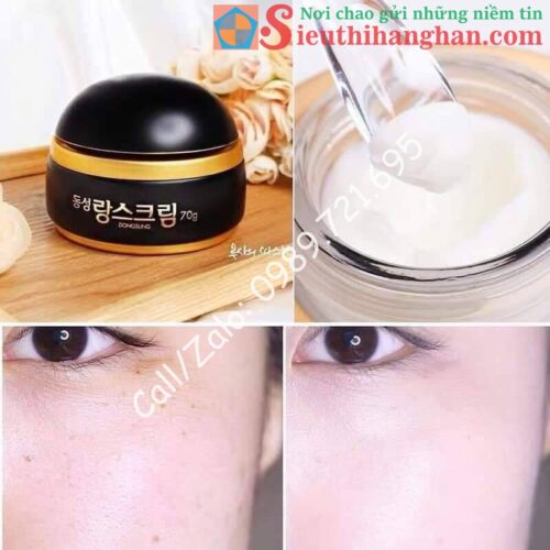 DONGSUNG RANNCE CREAM KEM TRỊ NÁM HIỆU QUẢ SỐ 1 HÀN QUỐC